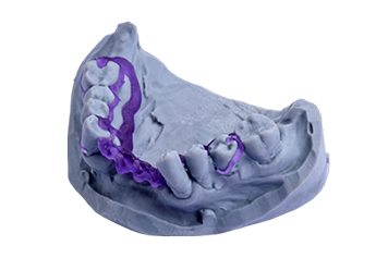 Dental Cast – D TECH DENTAL TECHNOLOGIES, 3D Printing Resins