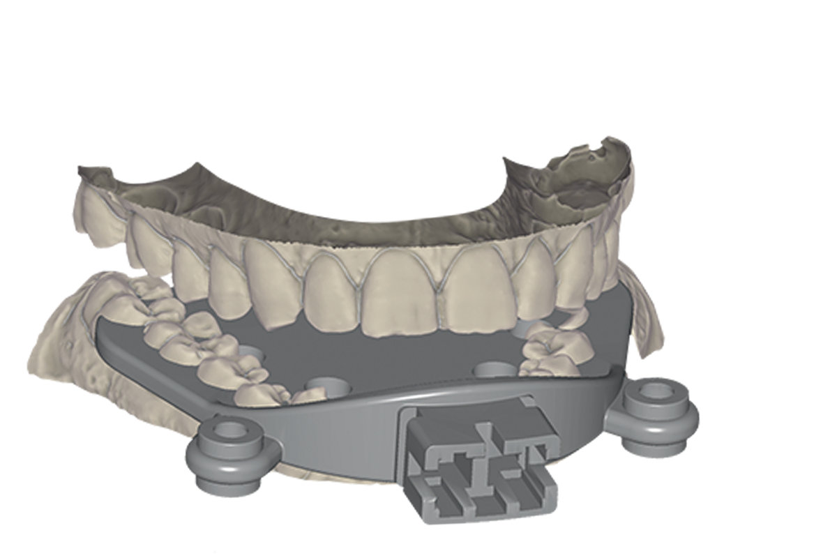 Jaw Motion Import Module