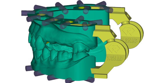 xSNAP Module