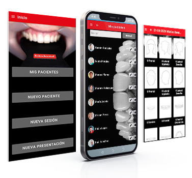 Application smartphone Fotodental – FOTODENTAL, CAD/CAM Software