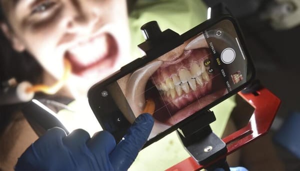 Fotodental Smartphone Illuminator