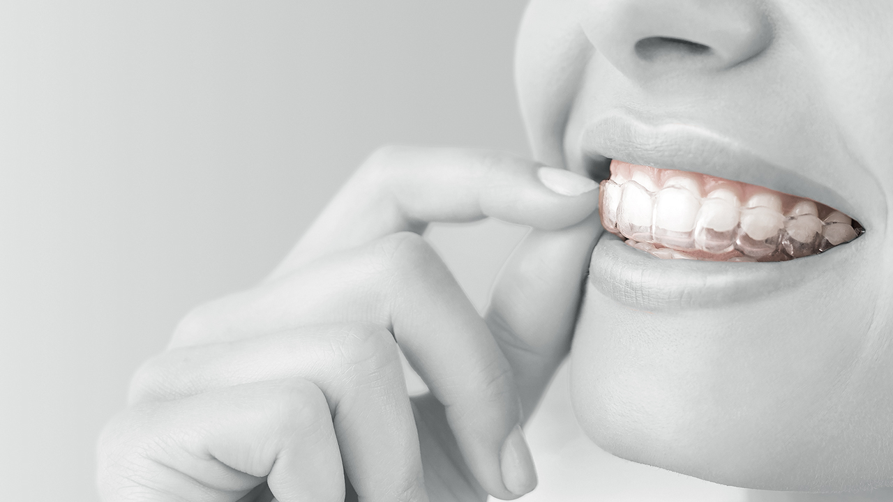 GT FLEX Clear Aligner & Retainer Material – GOOD FIT TECHNOLOGIES LLC, Clear Aligners