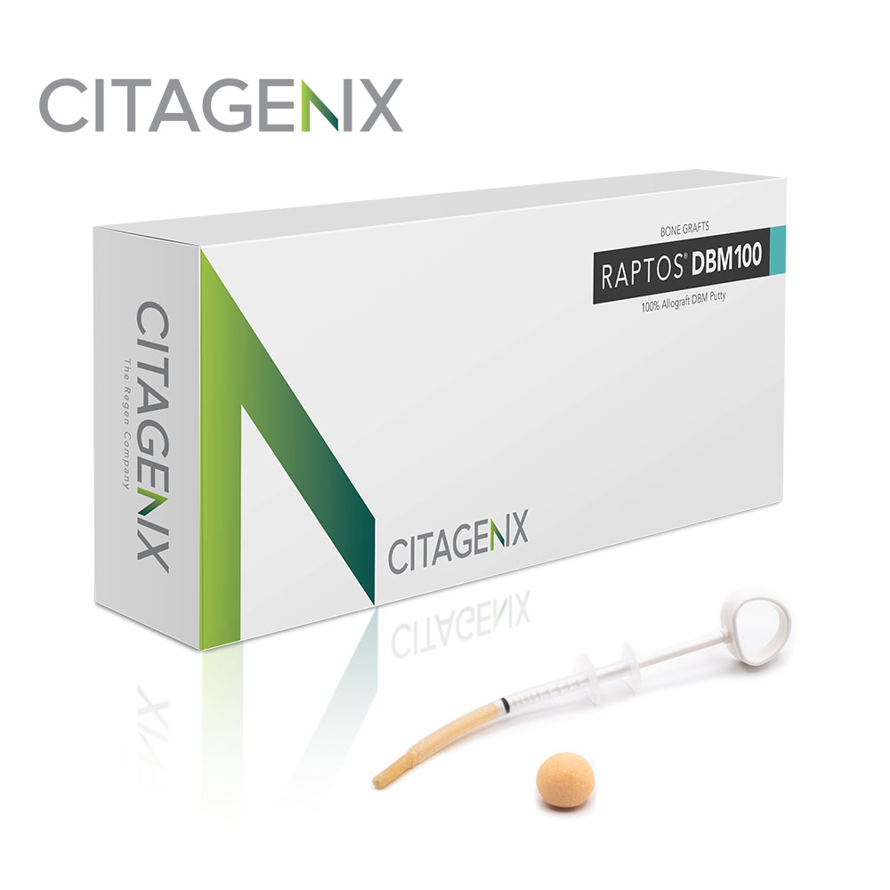 Raptos® DBM100 Putty – Citagenix Inc., Bone Graft Materials