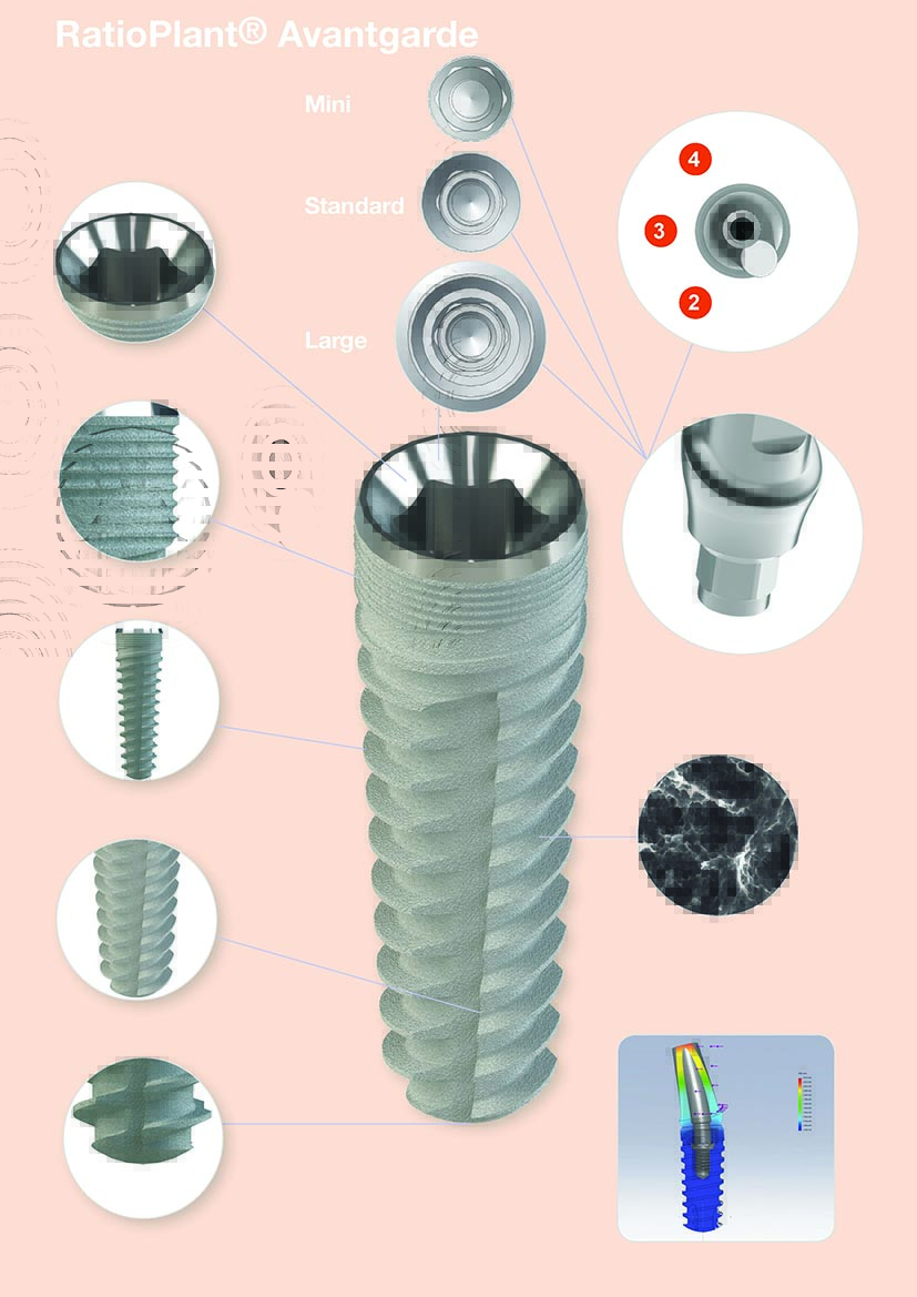 RatioPlant® Avantgarde