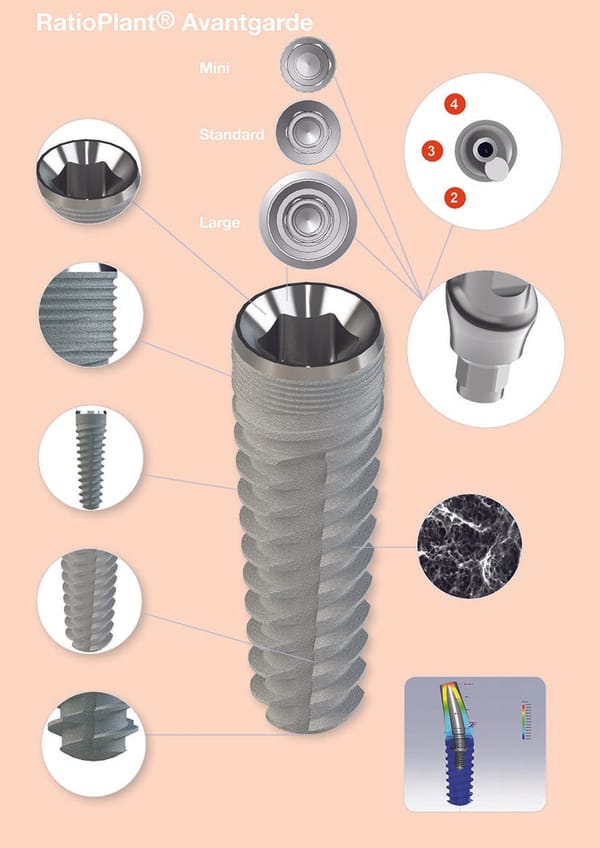 RatioPlant® Avantgarde