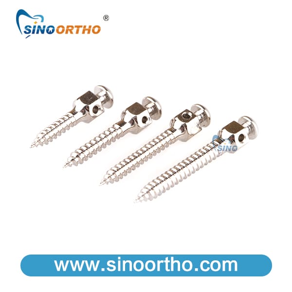 Orthodonitc Mini Implant Screw – Sino Ortho Limited, Verankerungssysteme