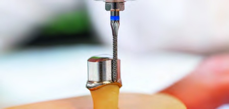 Teleskopfraser 0deg Long 500 123 137 103 012