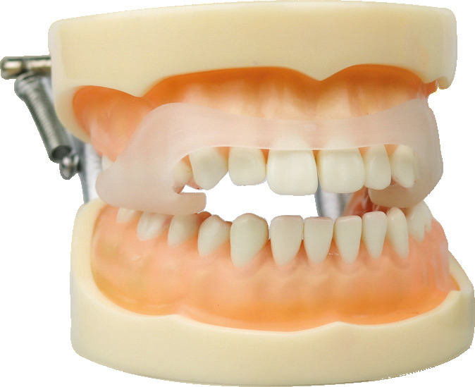RehaSplint Mini Medium – Dentrade GmbH & Co.KG, Intraoral Appliances