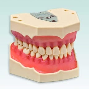AG-3 H KR Modèle d'hygiène avec caries – Frasaco, Gypsum Additives, Die Hardeners and Plaster Removers