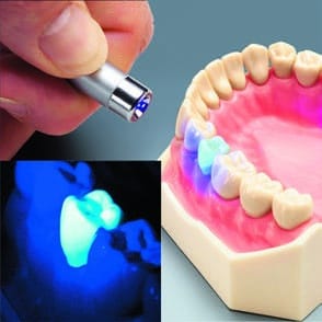 UV-L – Frasaco, Adhesives (Bonding)