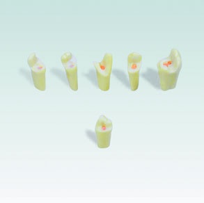 ANKA-4 ZEE Endodontischer Trepanationszahn (Kinderzahngröße)