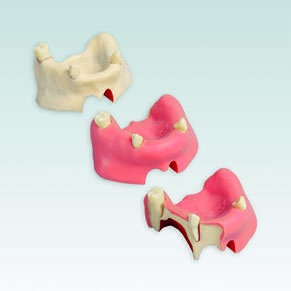 A-J F SOKW Implantat-Chirurgie OK Wachs