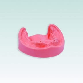 B-3 CSPJW UK 99-002 Implantat-Unterkiefer mit Knochen