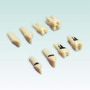 A-PB ZC Dent de parodontologie – Base avec tartre – Frasaco, Demonstration Models