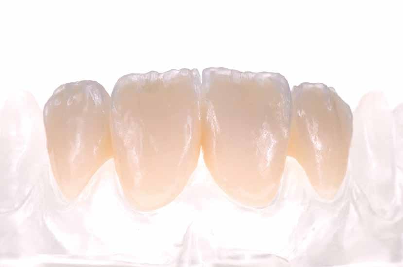 NyloBrush #2 – HPdent GmbH, Instrumente für Zahntechnik