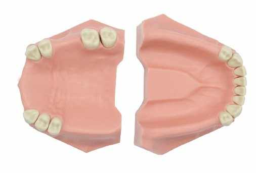 Partial Edentulous Hard Gums Model