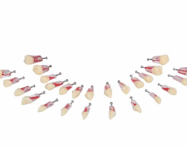 Replacement Teeth for Navadha Endo Jaw Set – Navadha Enterprises, Gypsum Additives, Die Hardeners and Plaster Removers