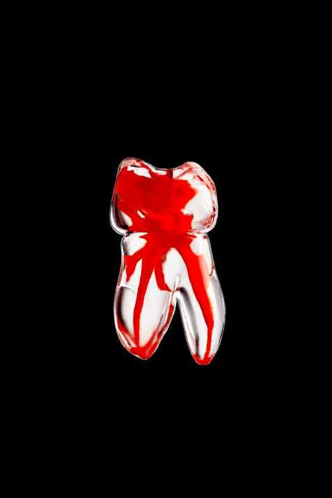 Dents endodontiques à canal radiculaire coloré (Dent n° 1.6/16)