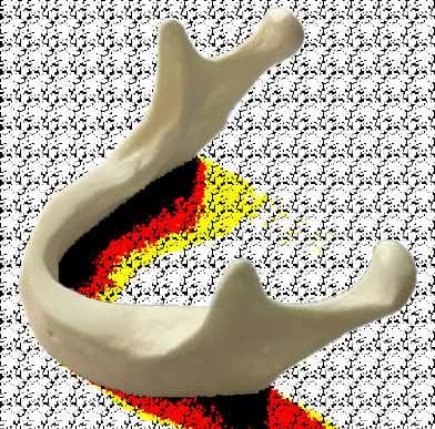 Anatomisch geformte einfache Mandibula