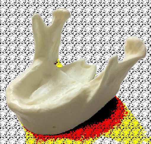 Unterkiefermodell für Implantattraining – Navadha Enterprises, Implant Surgical Kits