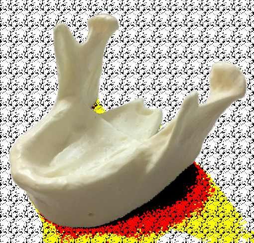 Modèle mandibulaire pour formation en implantologie