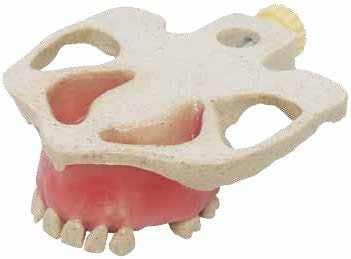 Modèle radio-opaque pour élévation sinusienne &amp; pose d'implants – Navadha Enterprises, Implantology
