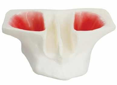 Modèle en résine pour sinus lift