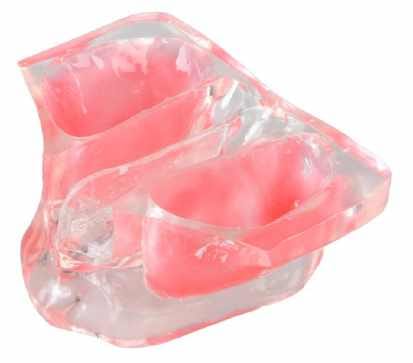 Transparentes Sinuslift-Modell
