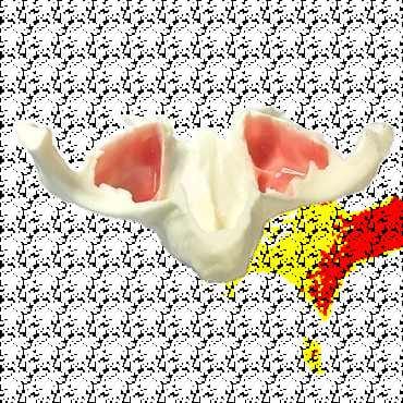 Mâchoire anatomique grandeur nature avec sinus pour implants zygomatiques