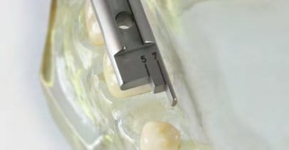 Compas CASTROVIEJO 15 cm – Schwert, Implantology