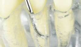 Curette GRACEY GRA 1/2 Standard – Schwert, Periodontal Surgery