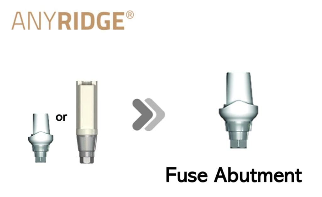 AnyRidge Fuse Abutment – MegaGen F.D. GmbH, Abutments