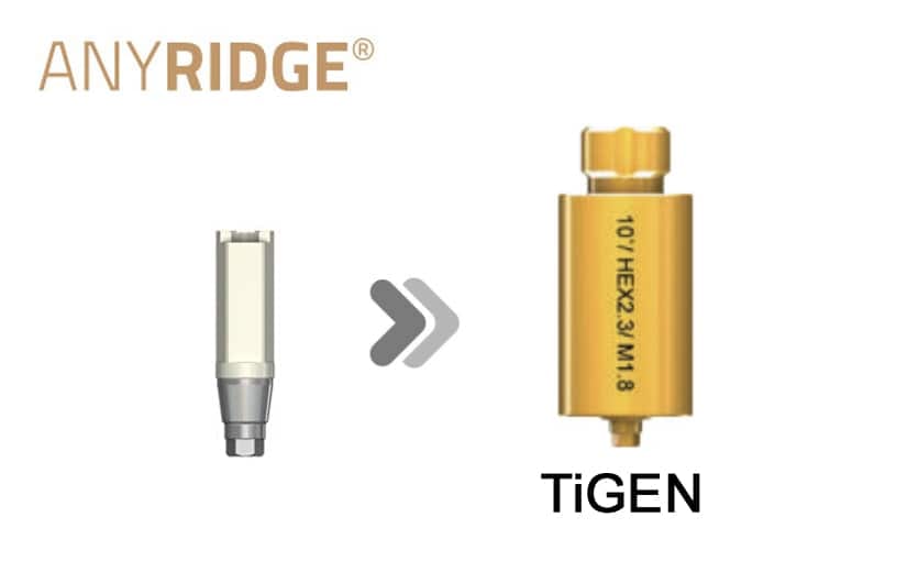 AnyRidge TiGEN (Pre-milled) – MegaGen F.D. GmbH, CAD/CAM-Software