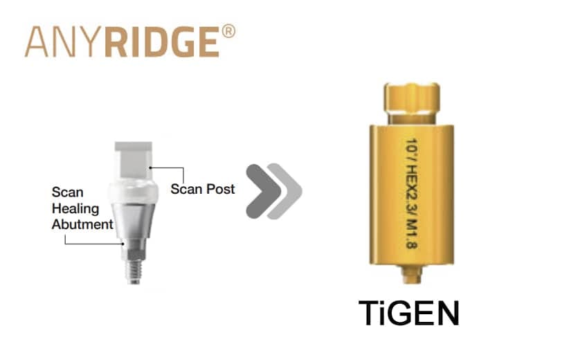 AnyRidge SHA TiGEN(Pre-milled) – MegaGen F.D. GmbH, CAD/CAM Software