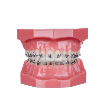 Pactive Typodont - Piece – IOS International Orthodontic Services, Intraoral Appliances