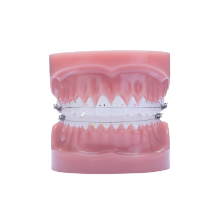 Phantom LP Typodont - Piece – IOS International Orthodontic Services, Intraoral Appliances