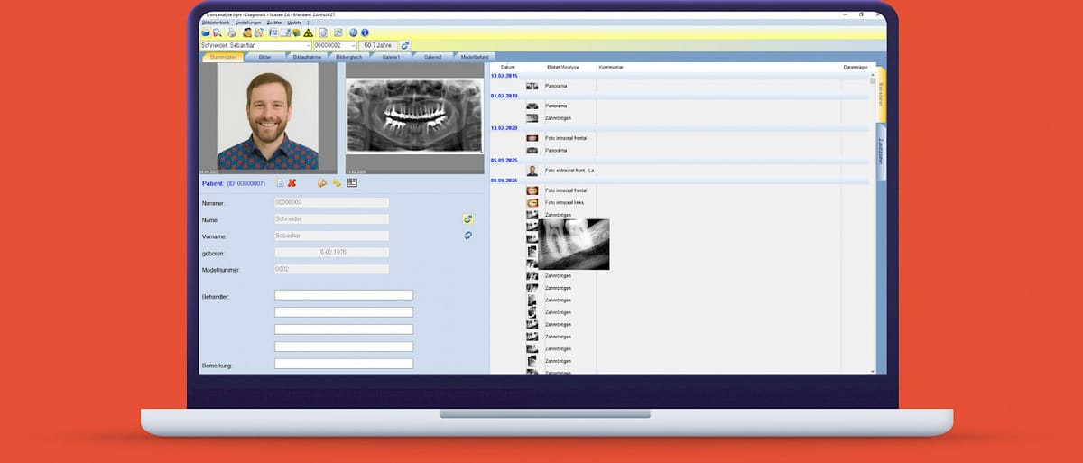 ivoris® analyze light – Computer konkret, CAD/CAM-Software