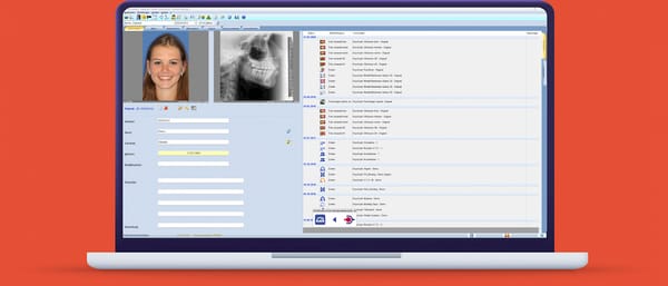 ivoris® analyze connect