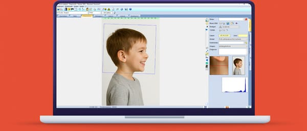 ivoris® analyze express