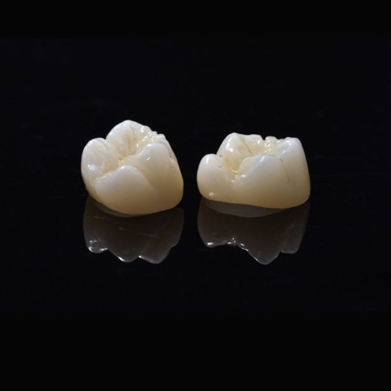 Zirconia Crowns – Krausz Dental Lab, Temporary Crowns