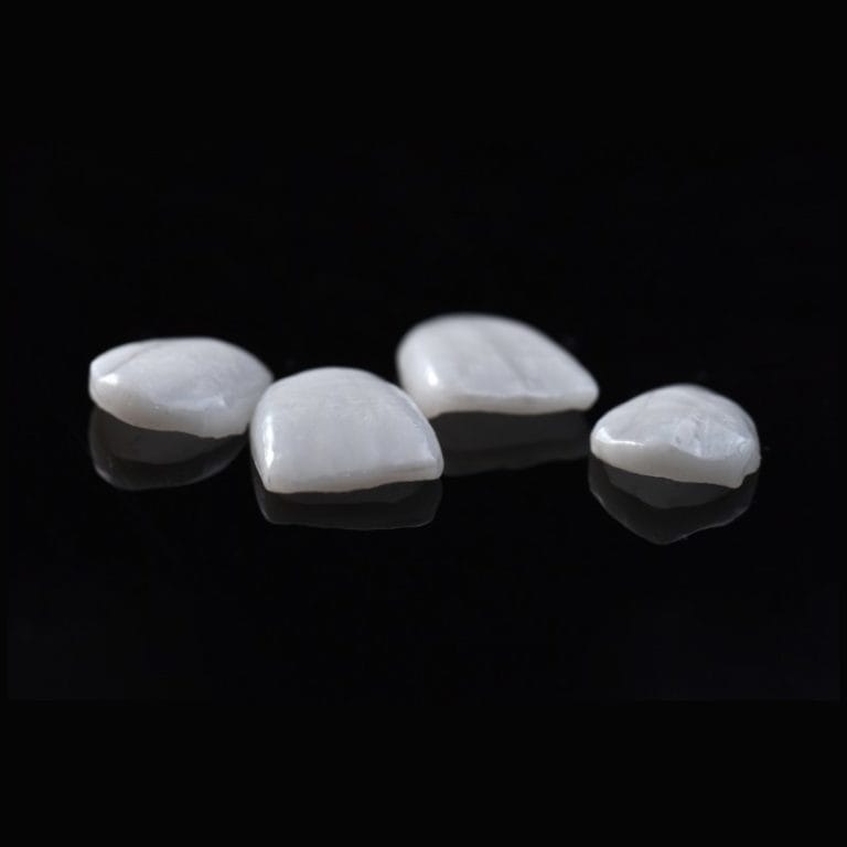 Laminate – Krausz Dental Lab, Temporary Crowns