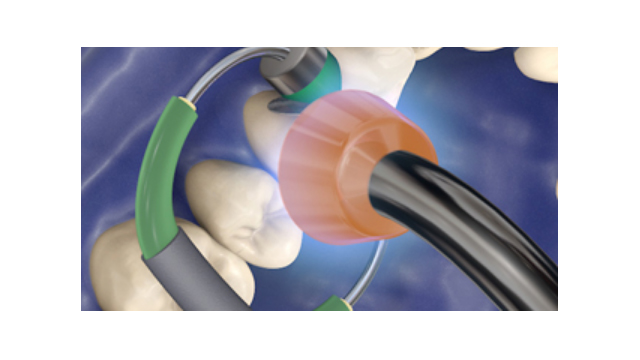 LED Curing Light – Kulzer, Curing Lights