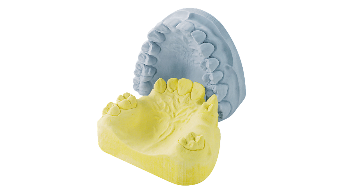 Moldadur – Kulzer, Gypsum Products