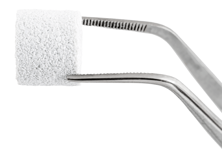 FlexiOss® – Medical Inventi S.A., Knochenersatzmaterial