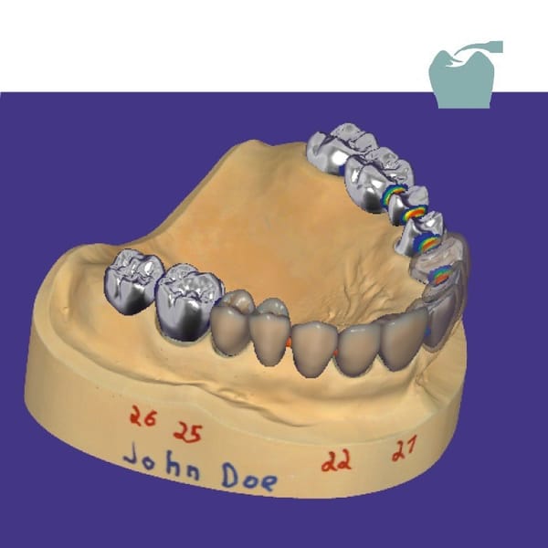 exocad DentalCAD (Basis)