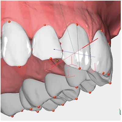 OnyxCeph™ 3D – Organical CAD/CAM, CAD/CAM Software