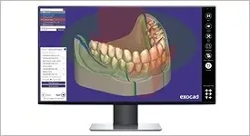 Exocad – Organical CAD/CAM, CAD/CAM Software
