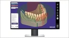 Exocad
