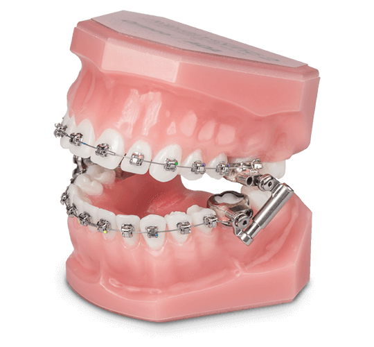 AdvanSync™2 – Ormco, Extraorale Geräte