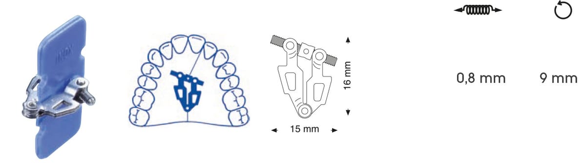 Asymmetrische Fächerdehnschraube – Orthobasics GmbH & Co. KG, Intraorale Geräte